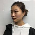 重庆超雅超声波去眼袋,精神抖擞面对明天287 重庆超雅超声波去眼袋,精神抖擞面对明天287