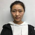 重庆超雅超声波去眼袋,精神抖擞面对明天287 重庆超雅超声波去眼袋,精神抖擞面对明天287