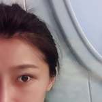 重庆超雅超声波去眼袋,精神抖擞面对明天287 重庆超雅超声波去眼袋,精神抖擞面对明天287