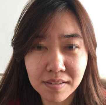 重庆超雅面部提升术,让你可以美美的拍照片459 重庆超雅面部提升术,让你可以美美的拍照片459