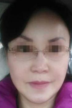 想燃烧青春的激情，来重庆超雅试试面部提升术！177