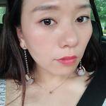 没了烦人的眼袋真的好看,谢谢超声波去眼袋314 没了烦人的眼袋真的好看,谢谢超声波去眼袋314
