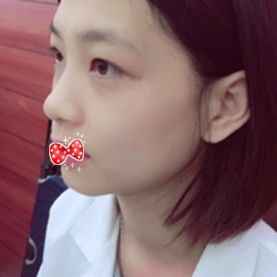 重庆超雅超 声 波去眼袋,脱离le眼袋困扰 重庆超雅超 声 波去眼袋,脱离le眼袋困扰