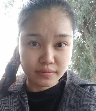 隆鼻手术也可以显脸小哦,不信来重庆超雅试试802 隆鼻手术也可以显脸小哦,不信来重庆超雅试试802