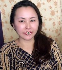 重庆超雅面部提升术让你定格住青春657 重庆超雅面部提升术让你定格住青春657