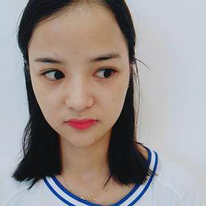 填充凹陷，抚平皱纹——超声波自体脂肪丰面手术604