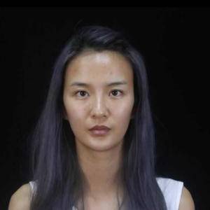 让人看不出真实年龄的超声波自体脂肪丰面手术022 让人看不出真实年龄的超声波自体脂肪丰面手术022