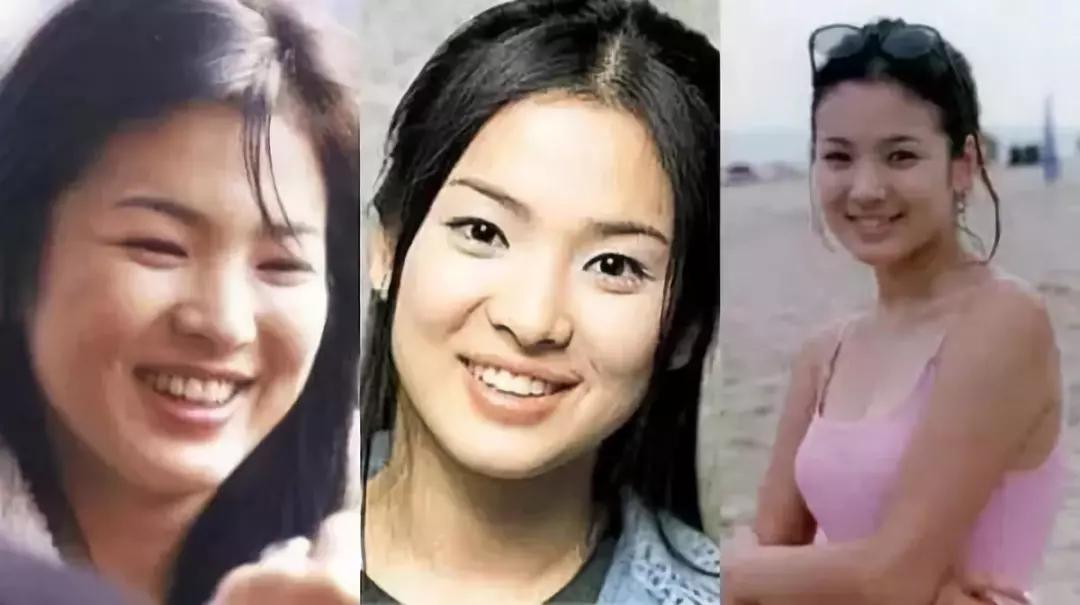 想整形而不被发现,重庆超雅满足你849 想整形而不被发现,重庆超雅满足你849