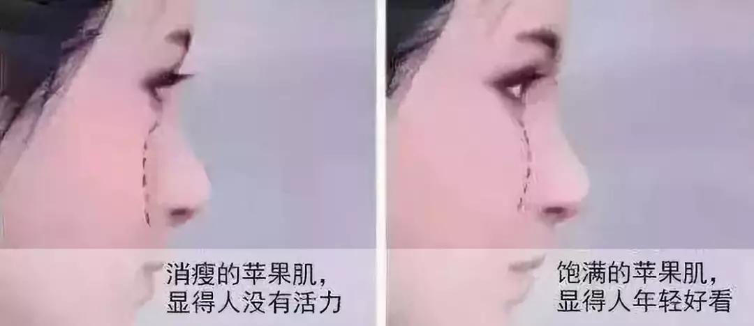重庆超雅自体脂肪填充术让你美美的过大年!347 重庆超雅自体脂肪填充术让你美美的过大年!347