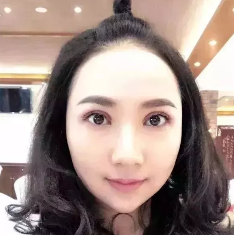 2018年度重庆超雅双眼皮手术案例大赏，你来评判！748