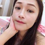 让我放心的超声波双眼皮191 让我放心的超声波双眼皮191