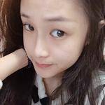 让我放心的超声波双眼皮191 让我放心的超声波双眼皮191