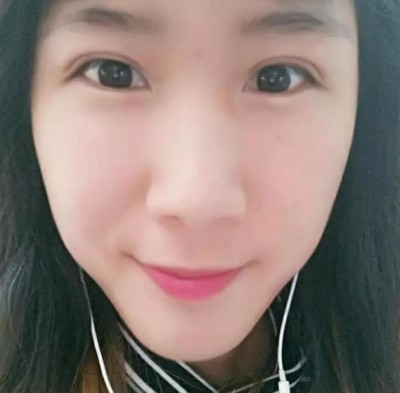 超声波双眼皮,让我的颜值提升了一大截655 超声波双眼皮,让我的颜值提升了一大截655