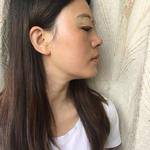 超声波双眼皮-期待更美的自己945 超声波双眼皮-期待更美的自己945