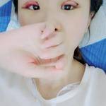 爱美的我做了超声波双眼皮163 爱美的我做了超声波双眼皮163