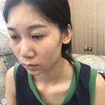 双眼皮一步到位,以后不再烦恼241 双眼皮一步到位,以后不再烦恼241