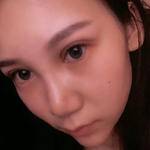 双眼皮一步到位,以后不再烦恼241 双眼皮一步到位,以后不再烦恼241