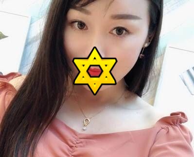 重庆超雅超 声 波去眼袋,不复发得轻松去眼袋 重庆超雅超 声 波去眼袋,不复发得轻松去眼袋