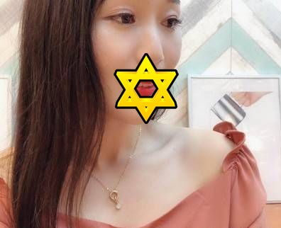 重庆超雅超 声 波去眼袋,不复发得轻松去眼袋 重庆超雅超 声 波去眼袋,不复发得轻松去眼袋