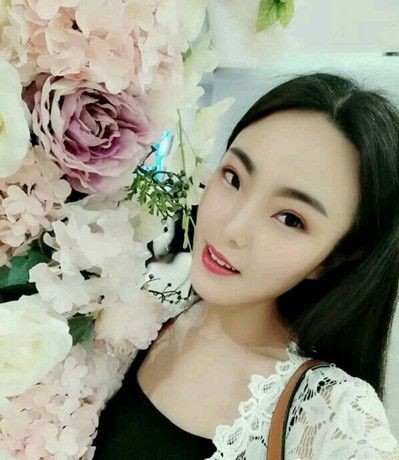 重庆超雅超 声 波双眼 皮，有le双眼 皮真得特别有气质