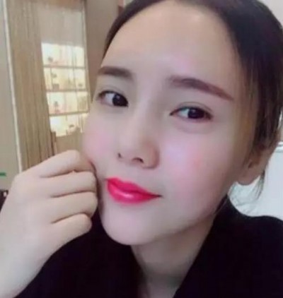 超 声 波去眼袋,再也不担心会长眼袋le 超 声 波去眼袋,再也不担心会长眼袋le