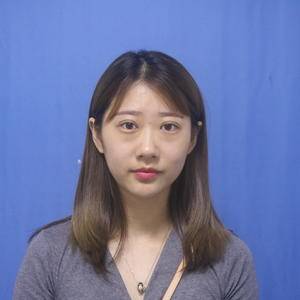 为什么选择超声波去眼袋呢?925 为什么选择超声波去眼袋呢?925