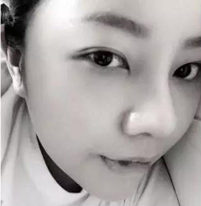超声波去眼袋,去掉眼袋让我心花怒放465 超声波去眼袋,去掉眼袋让我心花怒放465