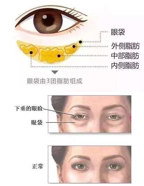 重庆超雅去眼袋手术后让我微微一笑很美丽908 重庆超雅去眼袋手术后让我微微一笑很美丽908