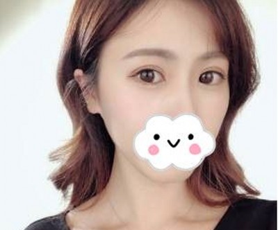 超声波去眼袋让我们再也无惧眼袋这岁月**!184 超声波去眼袋让我们再也无惧眼袋这岁月**!184