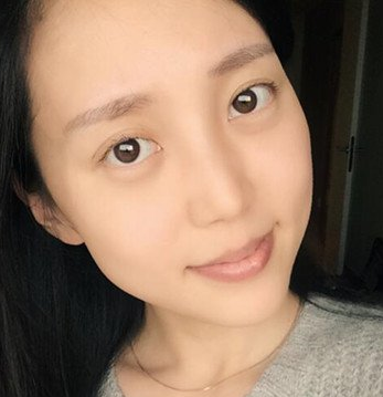 去眼袋,想变美上超雅! 去眼袋,想变美上超雅!