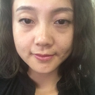 重庆超雅超 声 波去眼袋，去掉眼袋，给wǒ精致面容