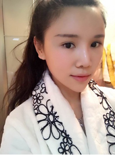 重庆超雅超 声 波去眼袋，美美得化个妆，再也不用遮掩眼袋le