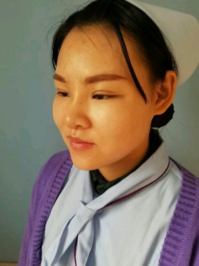 重庆超雅超声波双眼皮,自己理想的样子361 重庆超雅超声波双眼皮,自己理想的样子361