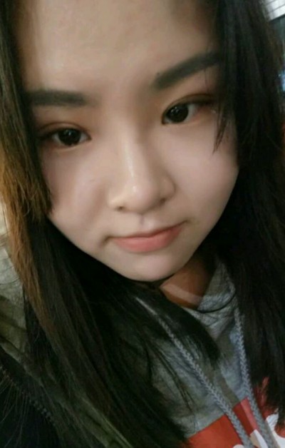 重庆超雅超声波双眼皮,自己理想的样子361 重庆超雅超声波双眼皮,自己理想的样子361