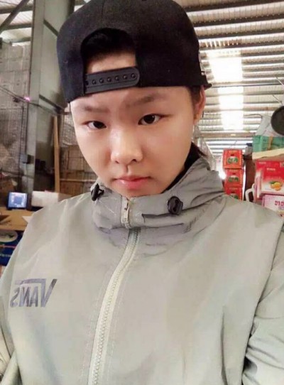 重庆超雅超声波双眼皮,自己理想的样子361 重庆超雅超声波双眼皮,自己理想的样子361