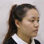超声波双眼皮让我更有女人味了186 超声波双眼皮让我更有女人味了186