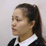 超声波双眼皮让我更有女人味了186 超声波双眼皮让我更有女人味了186