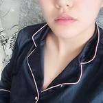 超声波双眼皮让我更有女人味了186 超声波双眼皮让我更有女人味了186