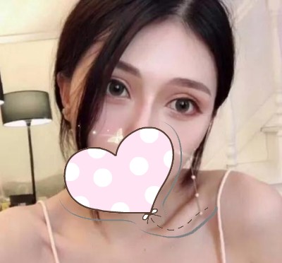 超声波双眼皮,自然流畅得双眼皮408 超声波双眼皮,自然流畅得双眼皮408