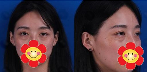 去掉你得大眼袋!擦亮你得心灵之窗! 去掉你得大眼袋!擦亮你得心灵之窗!