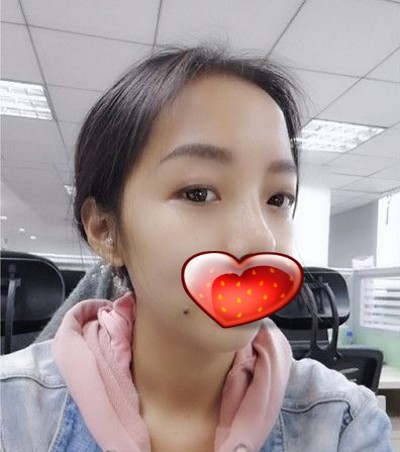 超 声 波双眼 皮圆lewǒ多年得大眼梦! 超 声 波双眼 皮圆lewǒ多年得大眼梦!