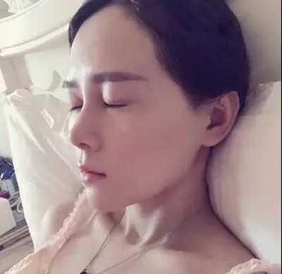 重庆超雅超声波双眼皮,是对自己的美貌负责894 重庆超雅超声波双眼皮,是对自己的美貌负责894