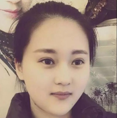 重生超雅超 声 波双眼 皮,更漂亮更有女人味 重生超雅超 声 波双眼 皮,更漂亮更有女人味