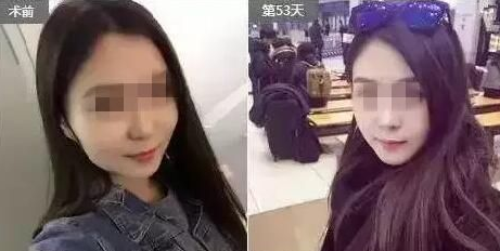 脸大过年也能有惊喜？重庆超雅超 声 波瘦脸在等你！
