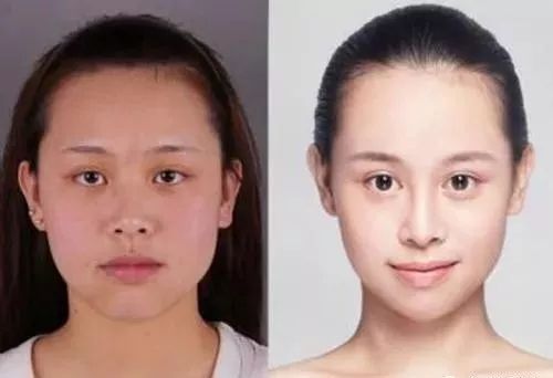 脸大过年也能有惊喜？重庆超雅超 声 波瘦脸在等你！