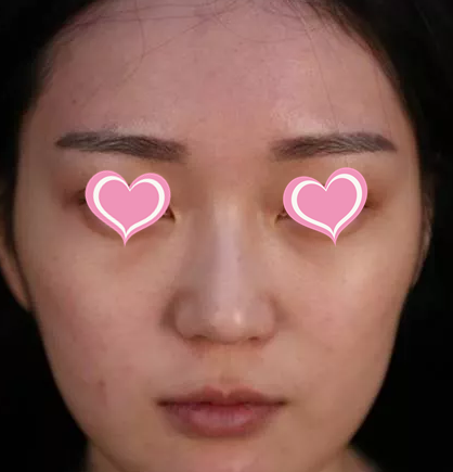 脸大过年也能有惊喜？重庆超雅超 声 波瘦脸在等你！