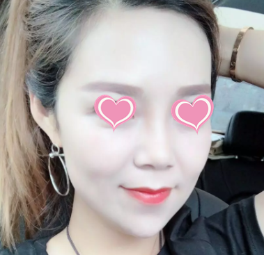 脸大过年也能有惊喜？重庆超雅超 声 波瘦脸在等你！