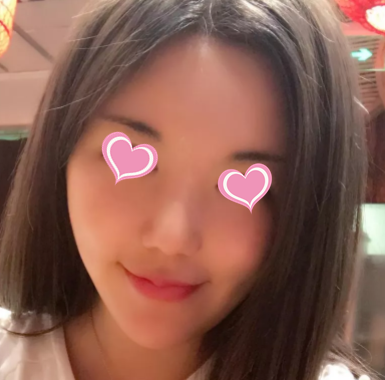 脸大过年也能有惊喜？重庆超雅超 声 波瘦脸在等你！