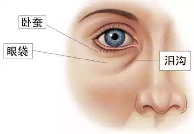 重庆超雅不开刀做去眼袋手术好用得很! 重庆超雅不开刀做去眼袋手术好用得很!