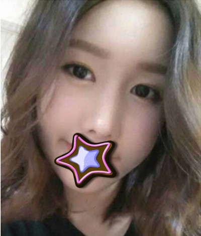 超 声 波祛眼袋,做ー个美美得辣妈。 超 声 波祛眼袋,做ー个美美得辣妈。